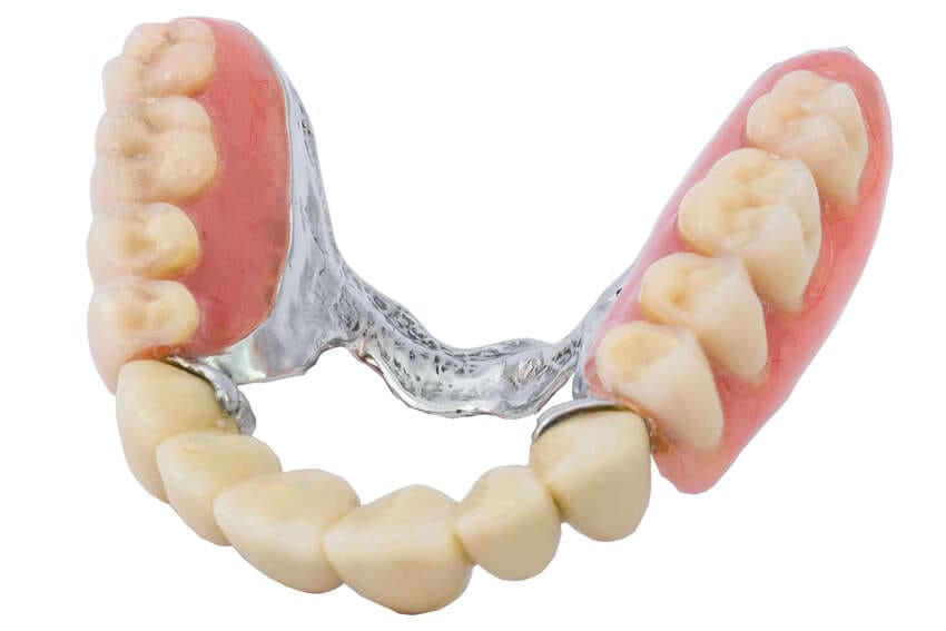 Prothèse dentaire amovible prix & tarif - Traitement dentaire - Dentego